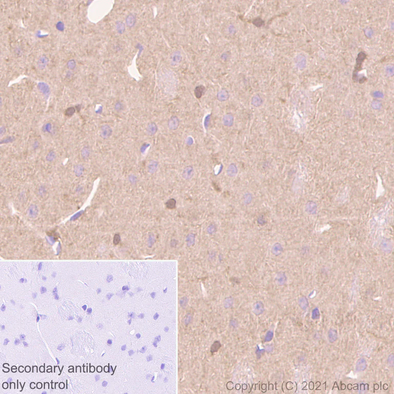 Immunohistochemistry (Formalin/PFA-fixed paraffin-embedded sections) - Anti-ENO1 + ENO2 + ENO3 antibody [EPR3377] - Neuronal Marker (AB79757)
