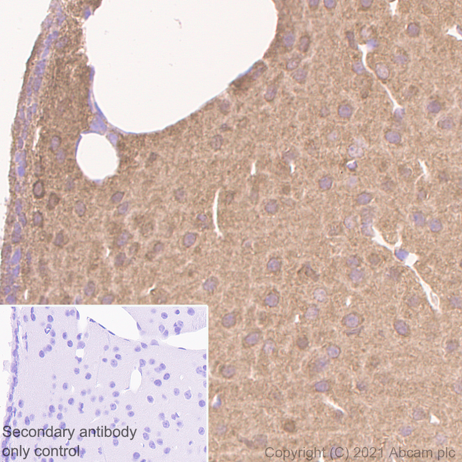 Immunohistochemistry (Formalin/PFA-fixed paraffin-embedded sections) - Anti-ENO1 + ENO2 + ENO3 antibody [EPR3377] - Neuronal Marker (AB79757), expandable thumbnail