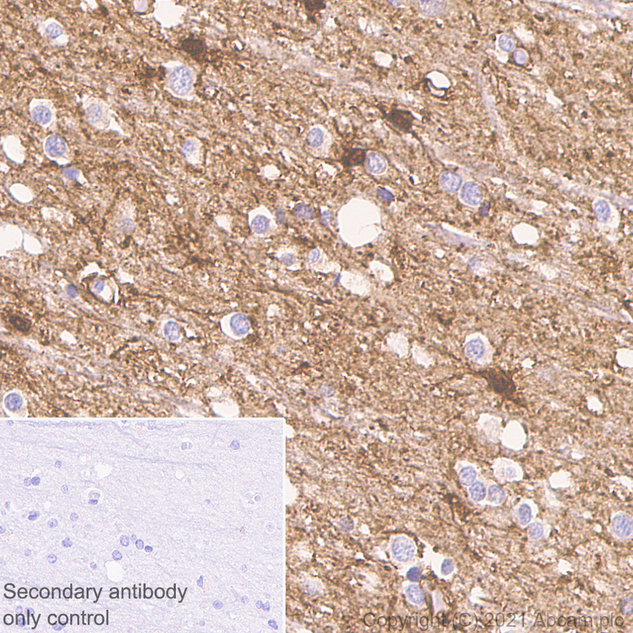 Immunohistochemistry (Formalin/PFA-fixed paraffin-embedded sections) - Anti-ENO1 + ENO2 + ENO3 antibody [EPR3377] - Neuronal Marker (AB79757), expandable thumbnail