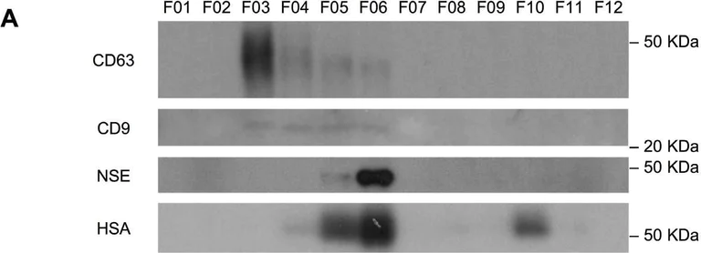 Western blot - Anti-ENO1 + ENO2 + ENO3 antibody [EPR3377] - Neuronal Marker (AB79757)