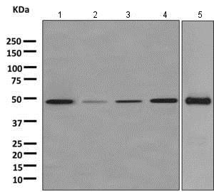 Western blot - Anti-ENO1 + ENO3 antibody [EPR11366(B)] (AB157474), expandable thumbnail