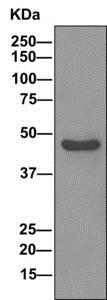 Western blot - Anti-ENO1 + ENO3 antibody [EPR11366(B)] (AB157474), expandable thumbnail