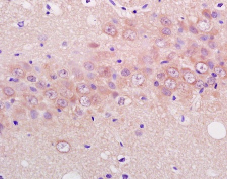 Immunohistochemistry (Formalin/PFA-fixed paraffin-embedded sections) - Anti-ENO3 antibody (AB203203), expandable thumbnail