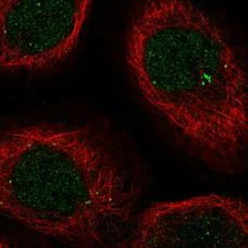 Immunocytochemistry/ Immunofluorescence - Anti-ENO4 antibody (AB204433)