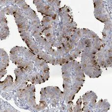 Immunohistochemistry (Formalin/PFA-fixed paraffin-embedded sections) - Anti-ENO4 antibody (AB204433)