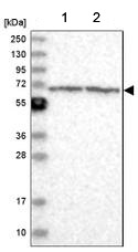 Western blot - Anti-ENO4 antibody (AB204433)