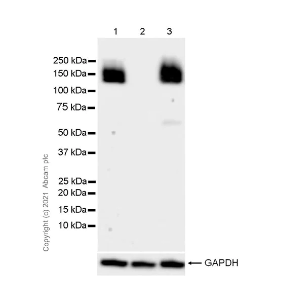 Western blot - Anti-eNOS antibody [3/eNOS/NOS Type III] (AB282109)