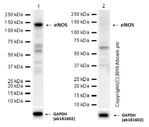 Western blot - Anti-eNOS antibody [EPR19296] (AB199956)
