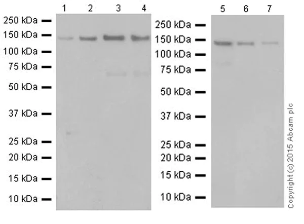 Western blot - Anti-eNOS antibody [EPR19296] (AB199956)