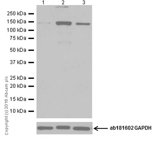 Western blot - Anti-eNOS antibody [EPR19296] (AB199956)