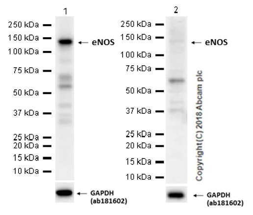 Western blot - Anti-eNOS antibody [EPR19296] - BSA and Azide free (AB240352)