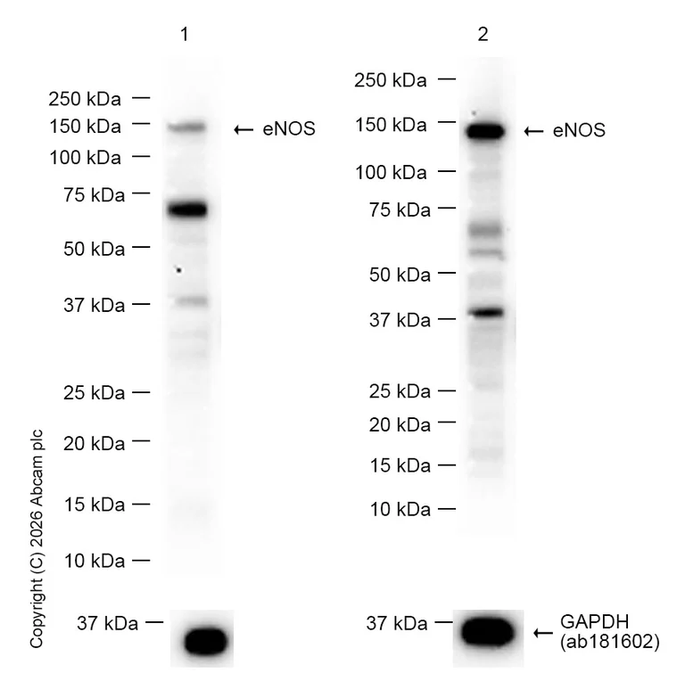 Western blot - Anti-eNOS antibody [EPR19296] - BSA and Azide free (AB240352)