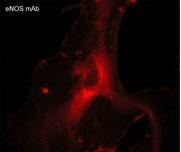 Immunocytochemistry/ Immunofluorescence - Anti-eNOS antibody [M221] (AB76198), expandable thumbnail
