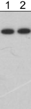 Western blot - Anti-eNOS antibody [M221] (AB76198), expandable thumbnail
