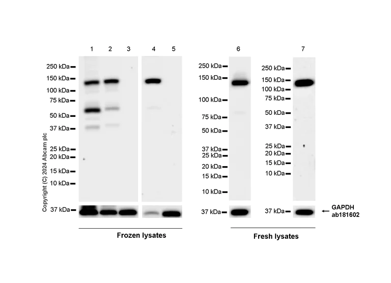 Western blot - Anti-eNOS antibody [RM1181] (AB317582)