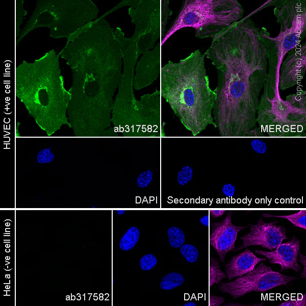Immunocytochemistry/ Immunofluorescence - Anti-eNOS antibody [RM1181] - BSA and Azide free (AB317583)