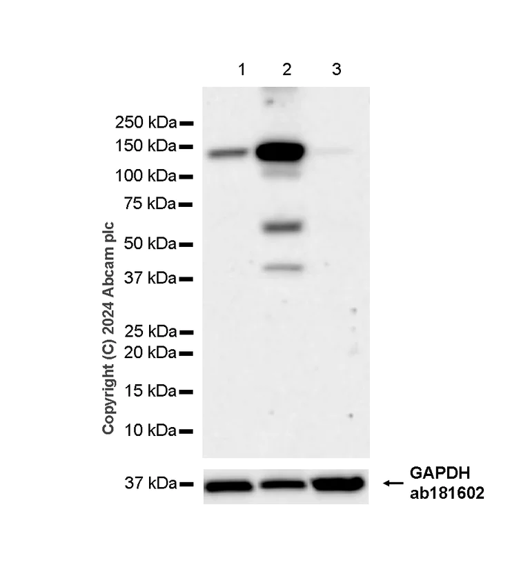 Western blot - Anti-eNOS antibody [RM1181] - BSA and Azide free (AB317583)