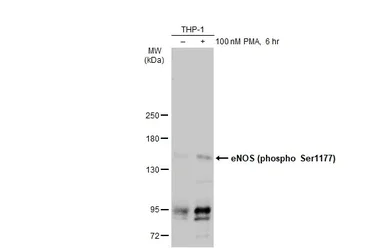 Western blot - Anti-eNOS (phospho S1177) antibody (AB184154)