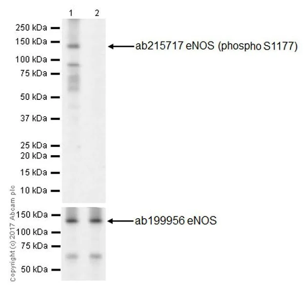 Western blot - Anti-eNOS (phospho S1177) antibody [EPR20991] (AB215717)