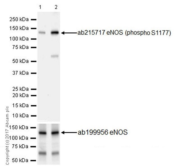 Western blot - Anti-eNOS (phospho S1177) antibody [EPR20991] (AB215717), expandable thumbnail