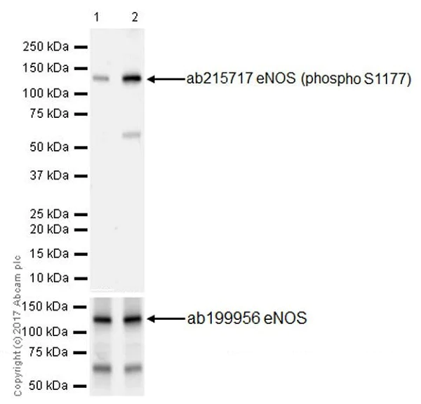 Western blot - Anti-eNOS (phospho S1177) antibody [EPR20991] (AB215717)