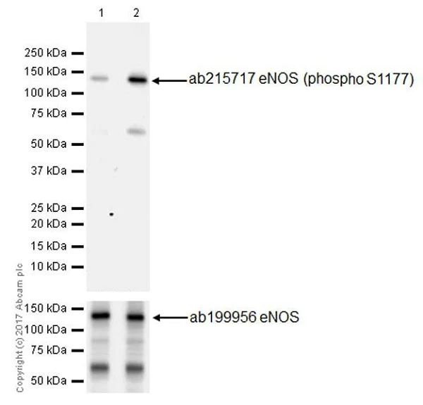 Western blot - Anti-eNOS (phospho S1177) antibody [EPR20991] - BSA and Azide free (AB230158)