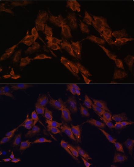 Immunocytochemistry/ Immunofluorescence - Anti-ENOX2/tNOX antibody (AB210751)