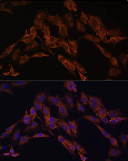 Immunocytochemistry/ Immunofluorescence - Anti-ENOX2/tNOX antibody (AB210751)