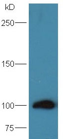 Western blot - Anti-ENPP1/PC1 antibody (AB217368)