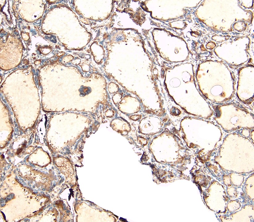 Immunohistochemistry (Formalin/PFA-fixed paraffin-embedded sections) - Anti-ENPP1/PC1 antibody (AB40003)