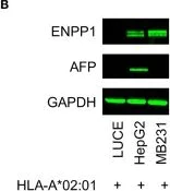 Western blot - Anti-ENPP1/PC1 antibody [EPR22262-22] (AB223268)
