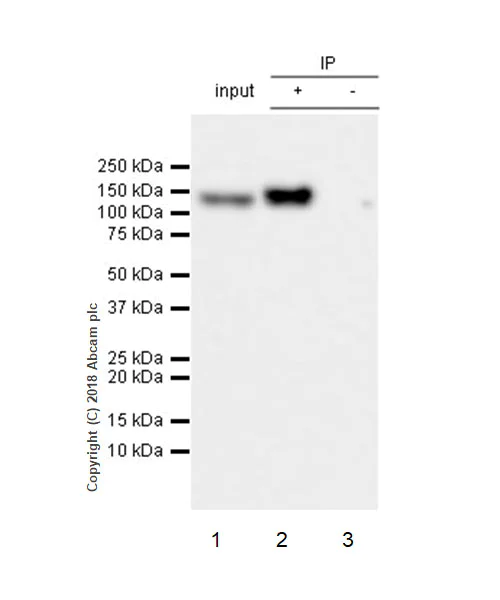 Immunoprecipitation - Anti-ENPP1/PC1 antibody [EPR22262-22] - BSA and Azide free (AB240832)