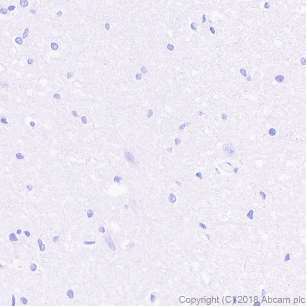 Immunohistochemistry (Formalin/PFA-fixed paraffin-embedded sections) - Anti-ENPP1/PC1 antibody [EPR22262-72] (AB245838)