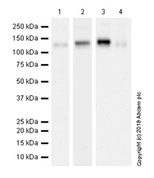 Western blot - Anti-ENPP1/PC1 antibody [EPR22262-75] (AB240653)