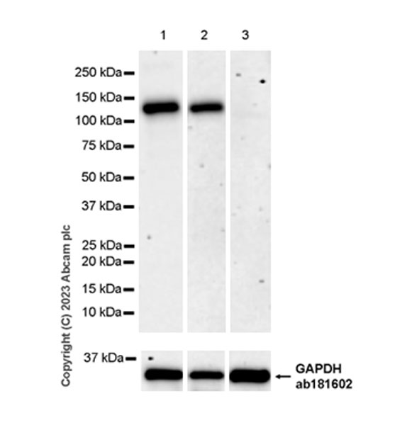 Western blot - Anti-ENPP1/PC1 antibody [EPR28388-32] - BSA and Azide free (ab314552), expandable thumbnail