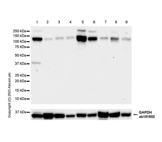 Western blot - Anti-ENPP1/PC1 antibody [EPR28388-32] - BSA and Azide free (AB314552), expandable thumbnail