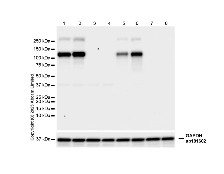 Western blot - Anti-ENPP1/PC1 antibody [EPR28388-32] - BSA and Azide free (AB314552)