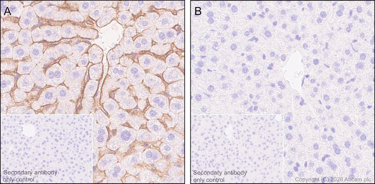 Immunohistochemistry (Formalin/PFA-fixed paraffin-embedded sections) - Anti-ENPP1/PC1 antibody [RM2066] (AB320007)