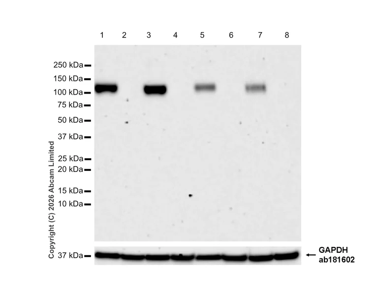Western blot - Anti-ENPP1/PC1 antibody [RM2066] (AB320007)