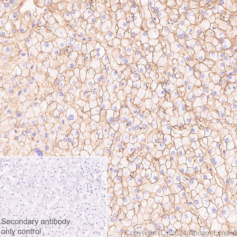 Immunohistochemistry (Formalin/PFA-fixed paraffin-embedded sections) - Anti-ENPP1/PC1 antibody [RM2066] - BSA and Azide free (AB320008)