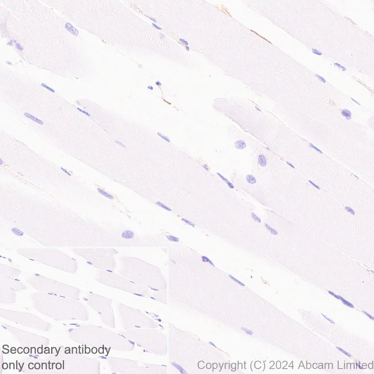 Immunohistochemistry (Formalin/PFA-fixed paraffin-embedded sections) - Anti-ENPP1/PC1 antibody [RM2066] - BSA and Azide free (AB320008)
