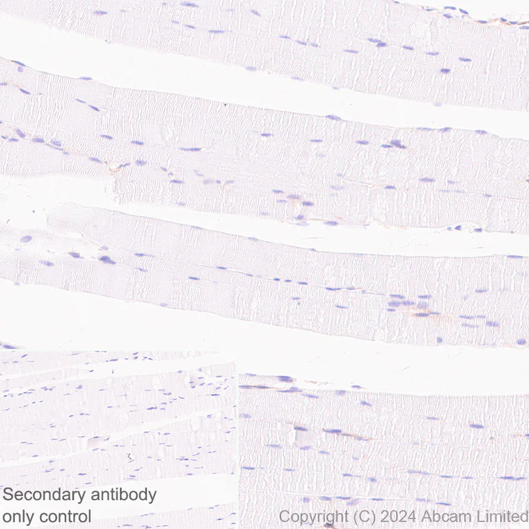 Immunohistochemistry (Formalin/PFA-fixed paraffin-embedded sections) - Anti-ENPP1/PC1 antibody [RM2066] - BSA and Azide free (AB320008)