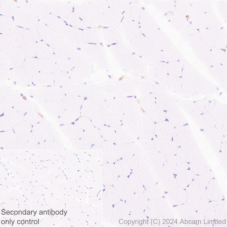 Immunohistochemistry (Formalin/PFA-fixed paraffin-embedded sections) - Anti-ENPP1/PC1 antibody [RM2066] - BSA and Azide free (AB320008)