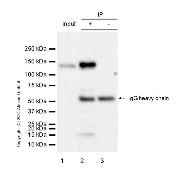 Immunoprecipitation - Anti-ENPP1/PC1 antibody [RM2066] - BSA and Azide free (AB320008)
