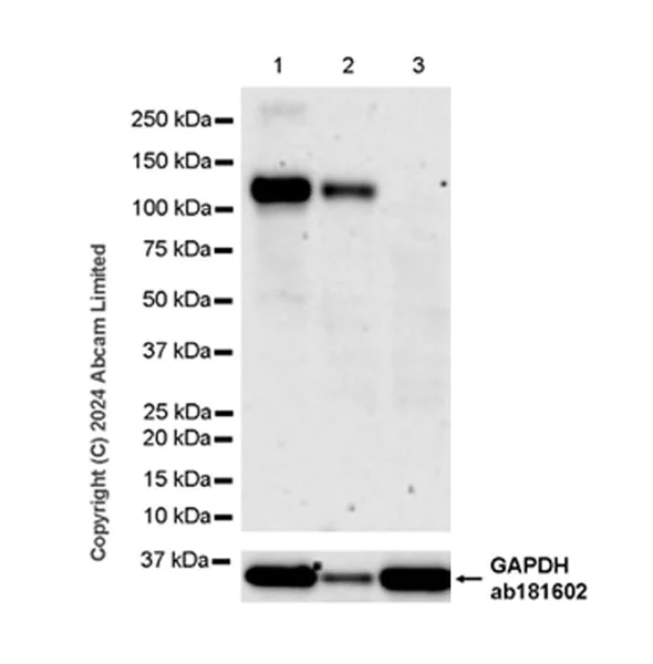 Western blot - Anti-ENPP1/PC1 antibody [RM2066] - BSA and Azide free (AB320008)