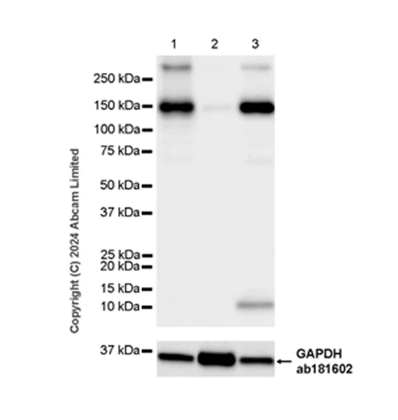 Western blot - Anti-ENPP1/PC1 antibody [RM2066] - BSA and Azide free (AB320008)