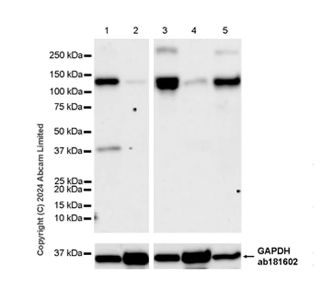 Western blot - Anti-ENPP1/PC1 antibody [RM2066] - BSA and Azide free (AB320008)