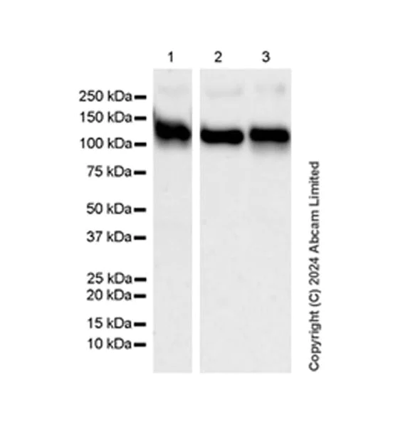 Western blot - Anti-ENPP1/PC1 antibody [RM2066] - BSA and Azide free (AB320008)