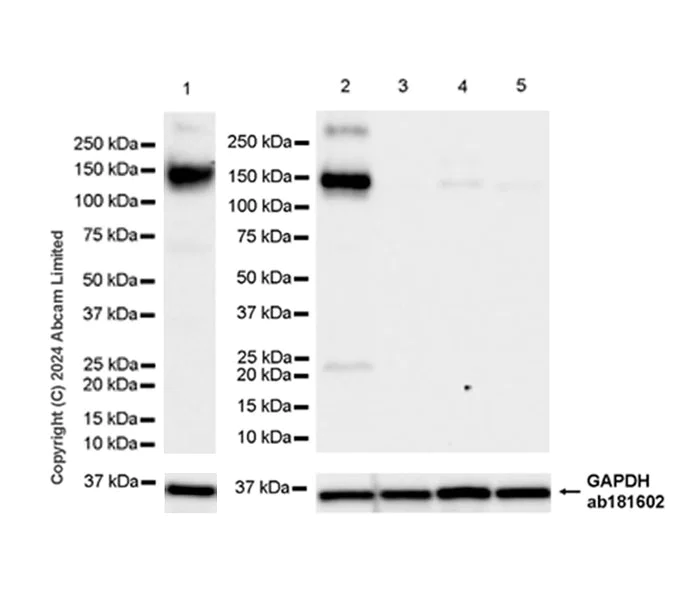 Western blot - Anti-ENPP1/PC1 antibody [RM2066] - BSA and Azide free (AB320008)