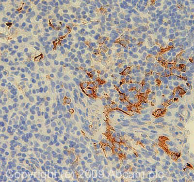 Immunohistochemistry (Formalin/PFA-fixed paraffin-embedded sections) - Anti-ENPP2/ATX antibody [1F8] - BSA and Azide free (AB238670), expandable thumbnail